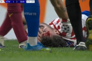 又血崩一个！鲁杰里被加维肘击倒地满脸是血，加维染黄